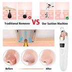 5 in 1  Blackhead Remover